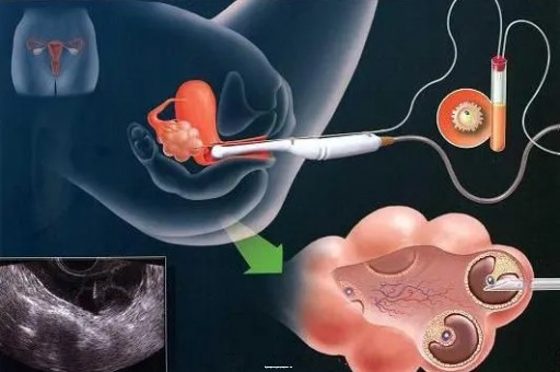 石家庄试管助孕机构哪家强？十大排名助你避坑!|调查